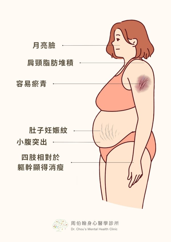 突發憂鬱、失眠與發胖!罕見庫欣氏症候群作怪